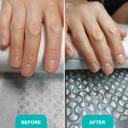 OIL FOR DAMAGED NAIL PLATE Comprehensive care for damaged and healthy nails 30 ml